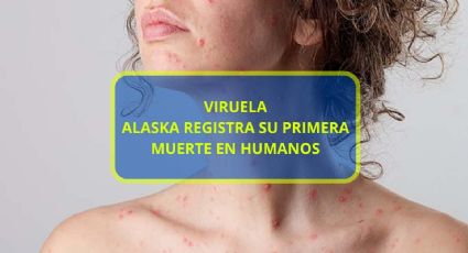 Enfermedad registra su primera muerte en humanos, la Viruela de Alaska, ¿qué es?