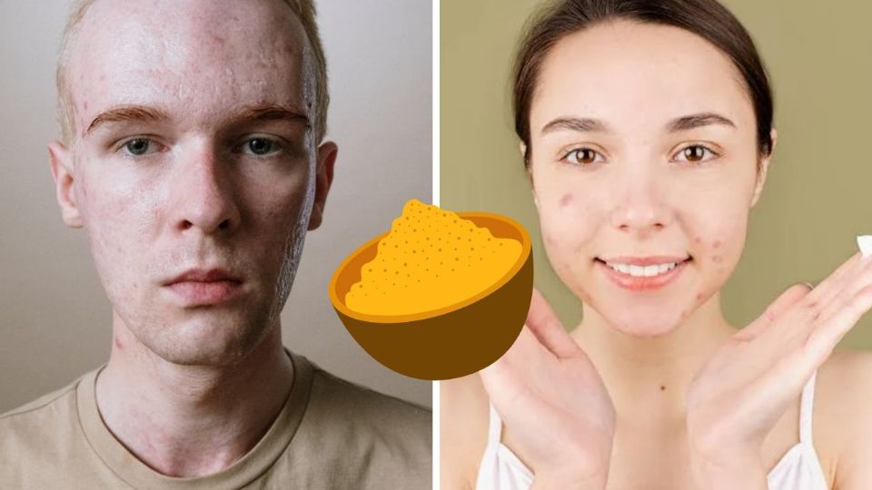 Este enfoque natural ofrece una alternativa sencilla y económica para quienes buscan complementar su rutina de cuidado sin recurrir a productos químicos agresivos
