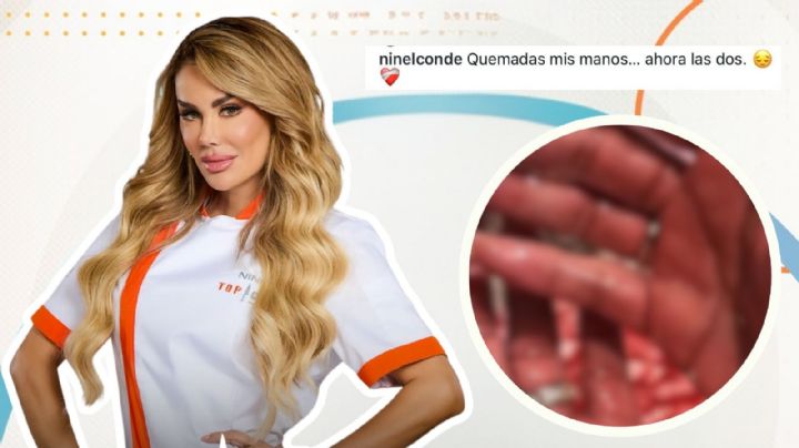 Ninel Conde alerta a sus fans tras sufrir una quemadura en Top Chef VIP 2026: “Oren por mí” | VIDEO