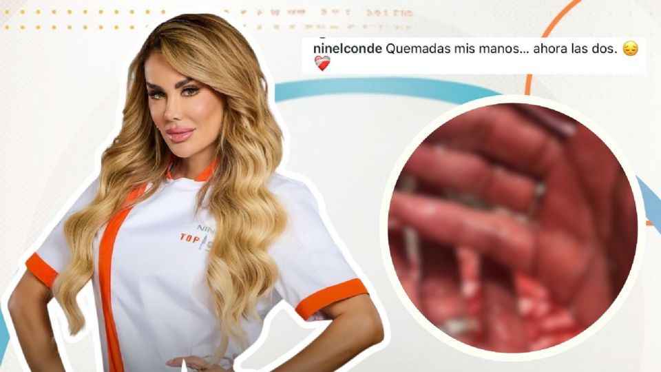 Ninel Conde sufre quemadura en Top Chef VIP 2026.